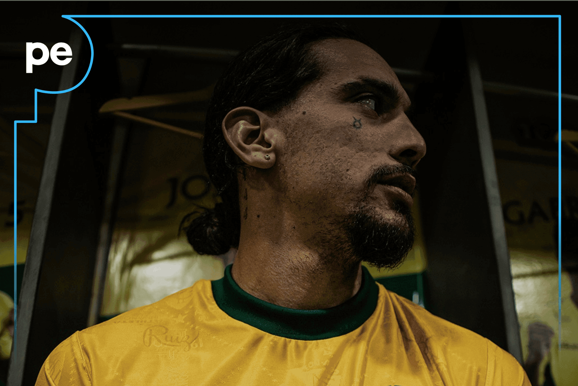 Chico da Costa, do Mirassol, tem lesão na coxa e inicia tratamento